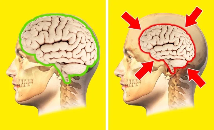 ما هو ضمور المخ وما هي أهم و أشهر أعراضه وأسبابه