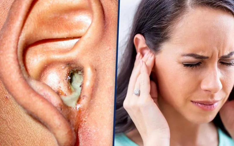 ما هى طرق علاج التهاب الأذن الداخلية؟