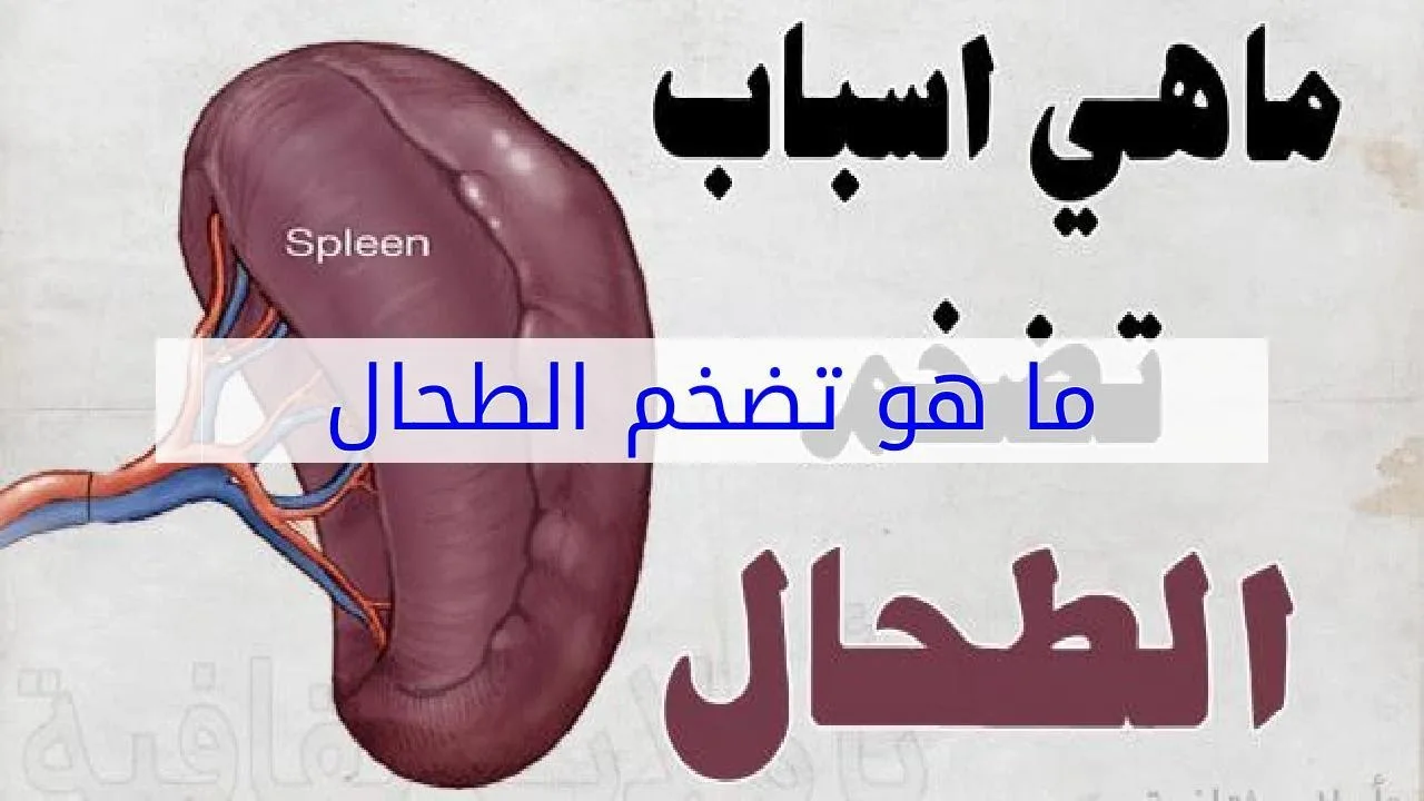 ما هي اعراض تضخم الطحال وما هي أسبابه وعلاجة